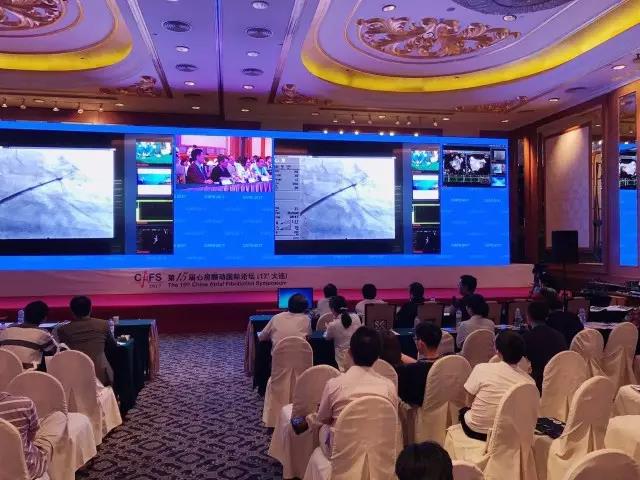 （图：专家学者当真旁观LAmbre?左心耳封堵器系统中国上市后首例手术演示）